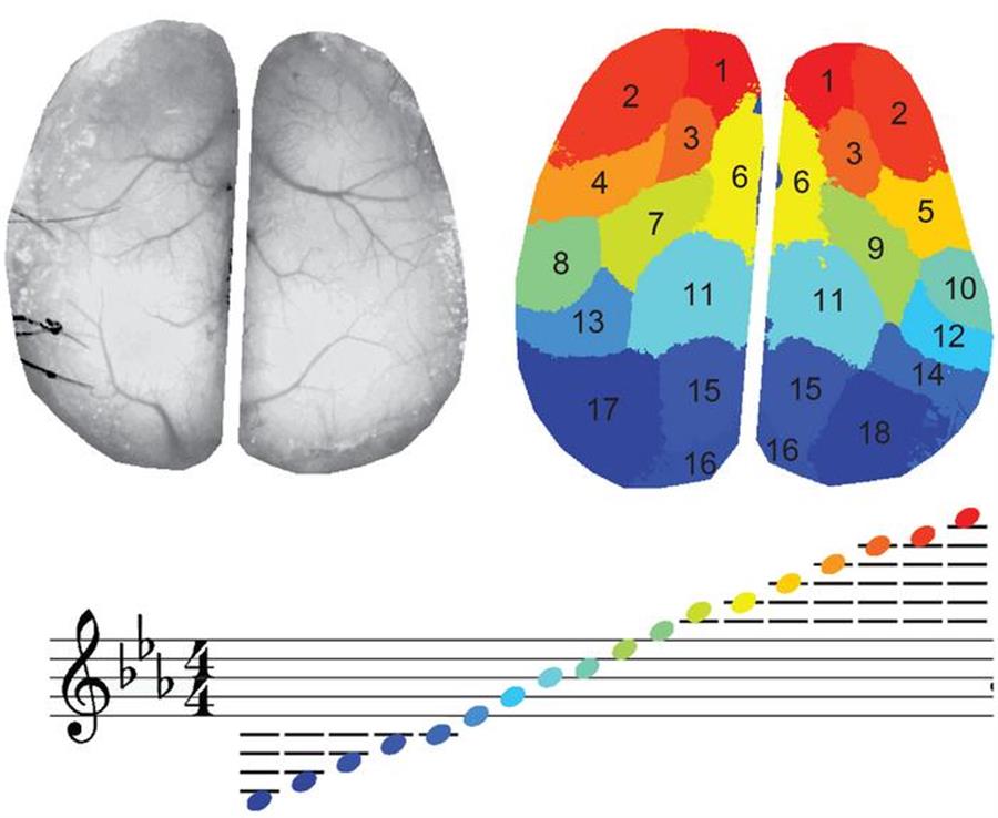 La actividad cerebral traducida a color y música para facilitar su interpretación médica