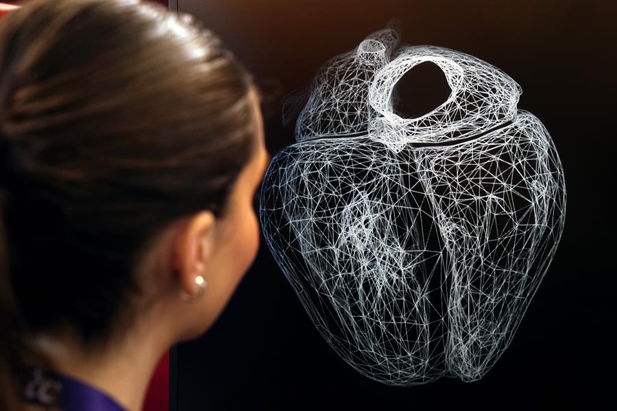 Un corazón ‘gemelo virtual’, réplica del real, para experimentar y predecir patologías