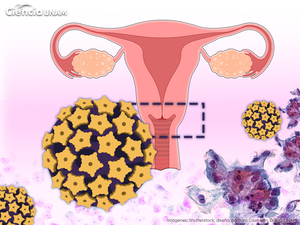 Especial Día de la Mujer. Aumento de cáncer cérvico uterino en jóvenes