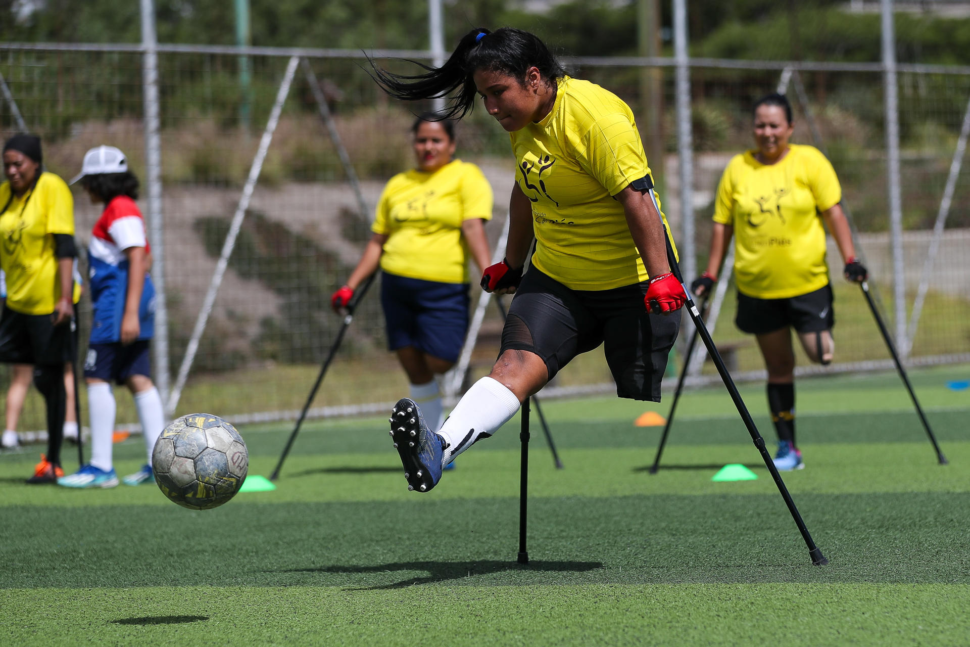 Mujeres amputadas en Ecuador, buscan convertirse en la selección nacional