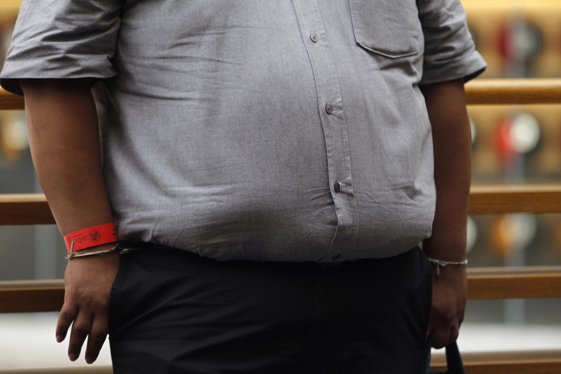 Una de cada ocho personas en el mundo sufre obesidad, la forma más común de malnutrición