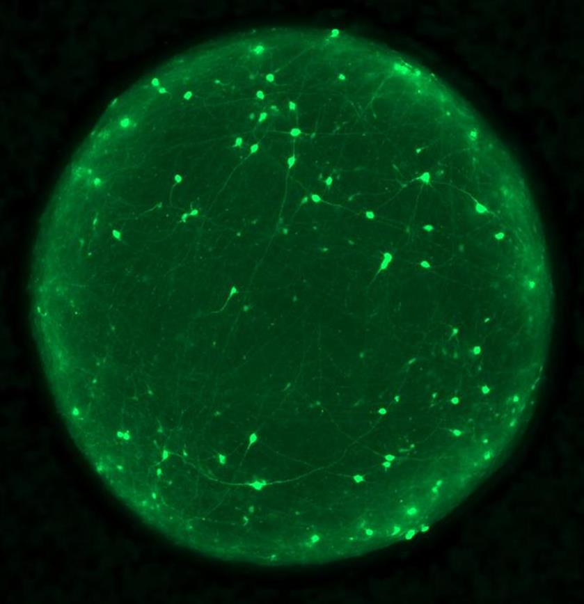 Descubren el papel de una proteína clave en las lesiones cerebrales traumáticas