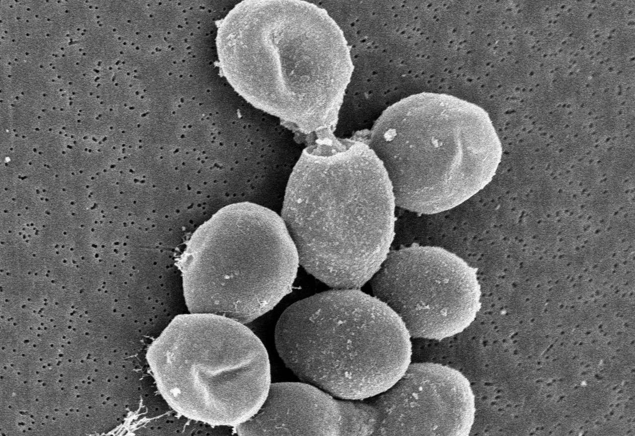 Patentan un método para producir serotonina a partir de una levadura del vino