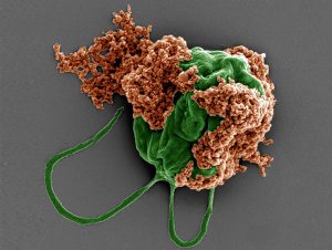Microrobots-nadadores-llevan-farmacos-contra-tumores-metastasicos-a-los-pulmones