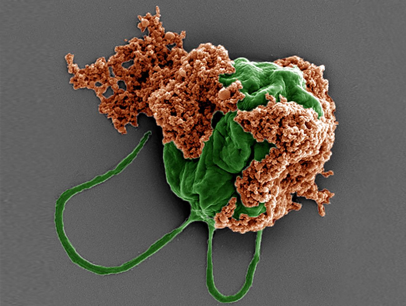 Microrobots llevan fármacos contra tumores metastásicos a los pulmones