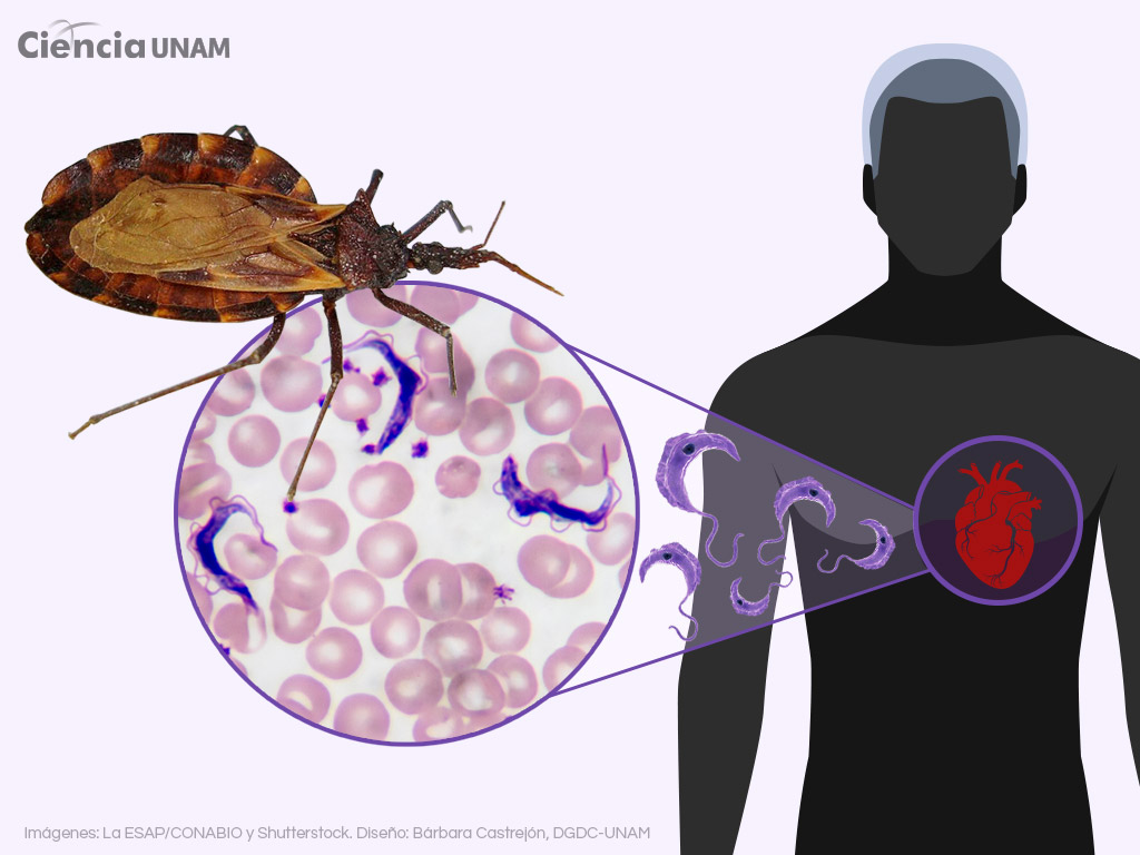 La olvidada enfermedad de Chagas