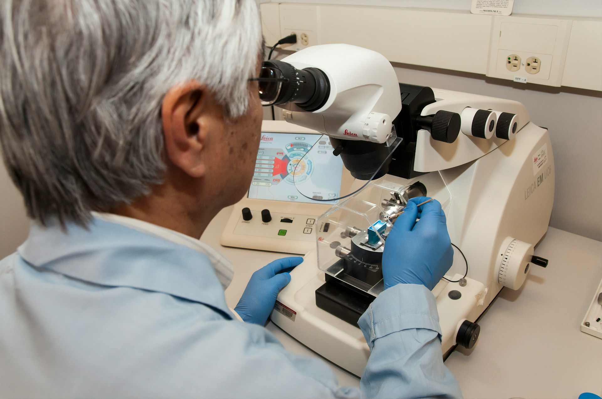 Biomarcadores en tejido sano podrían prever recaídas en el cáncer de mama más común