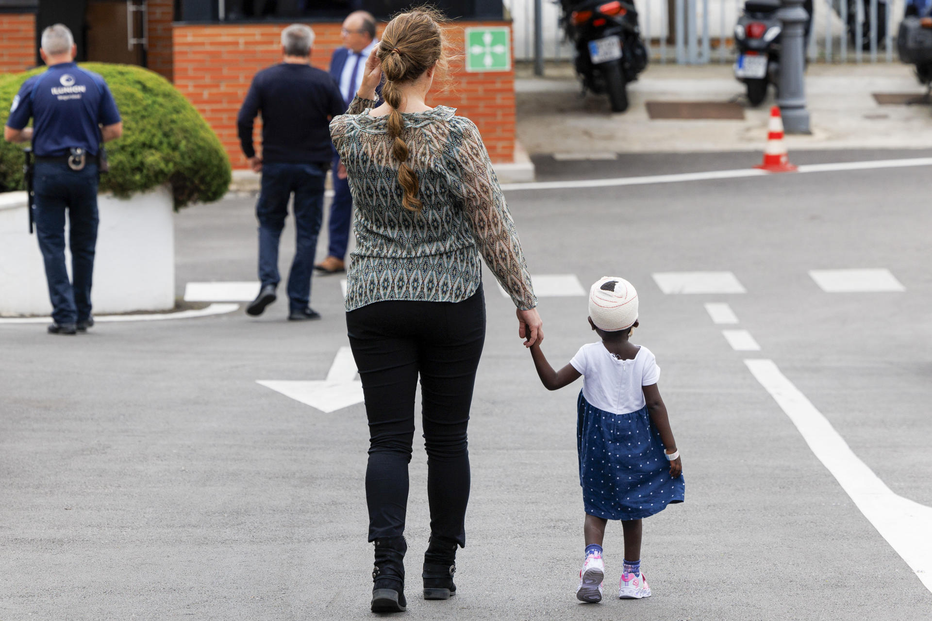 En España operan con éxito a una niña con un defecto congénito craneoencefálico