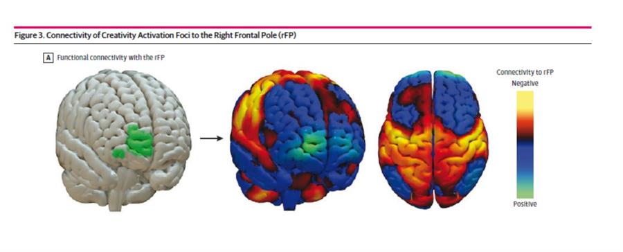 Identifican un circuito cerebral que implica a varias regiones y controla la creatividad