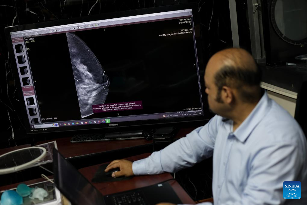 Proyecto busca mejorar el diagnóstico de cáncer de mama con modelos 3D