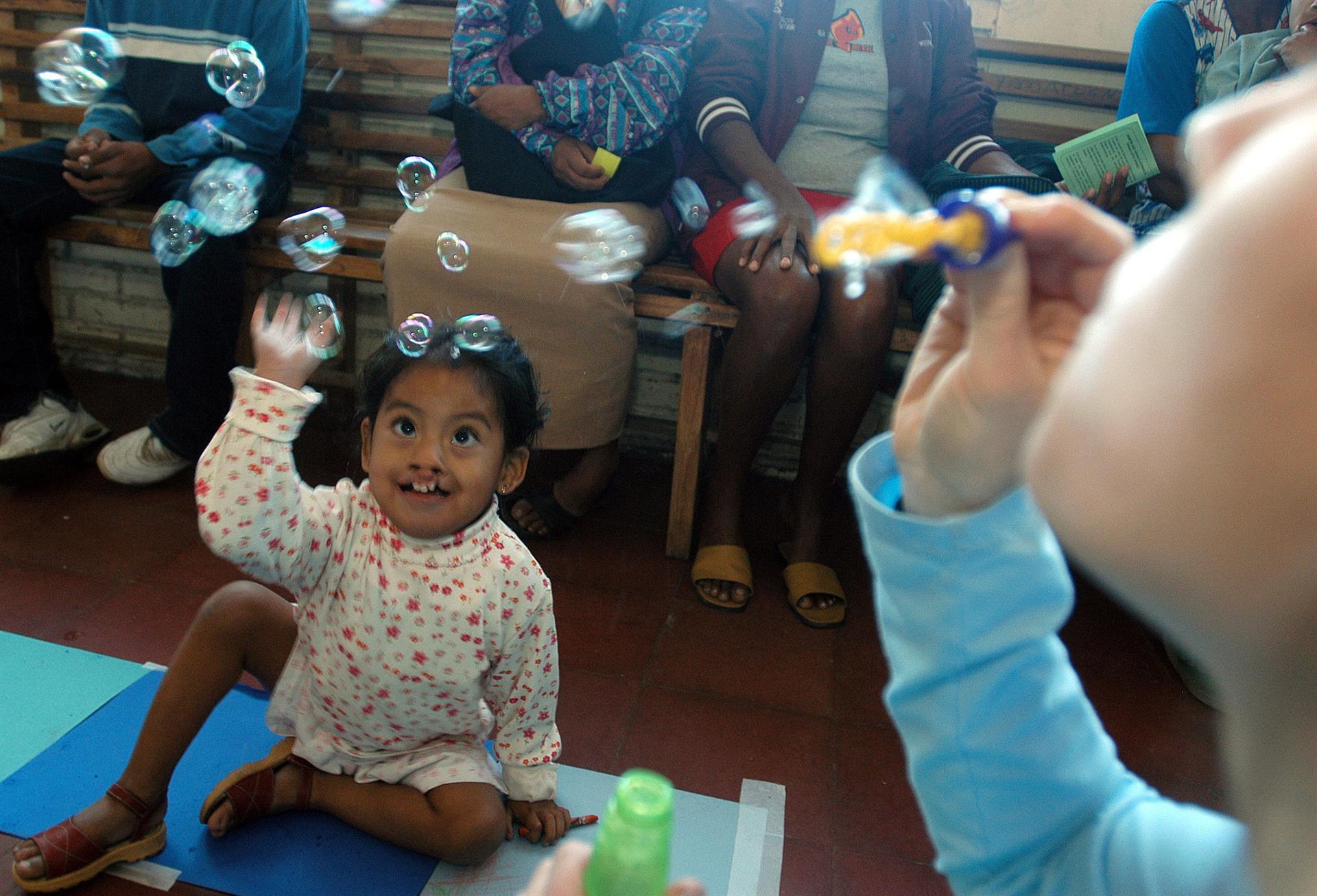 El trabajo en red transforma la vida de niños con paladar hendido en Colombia