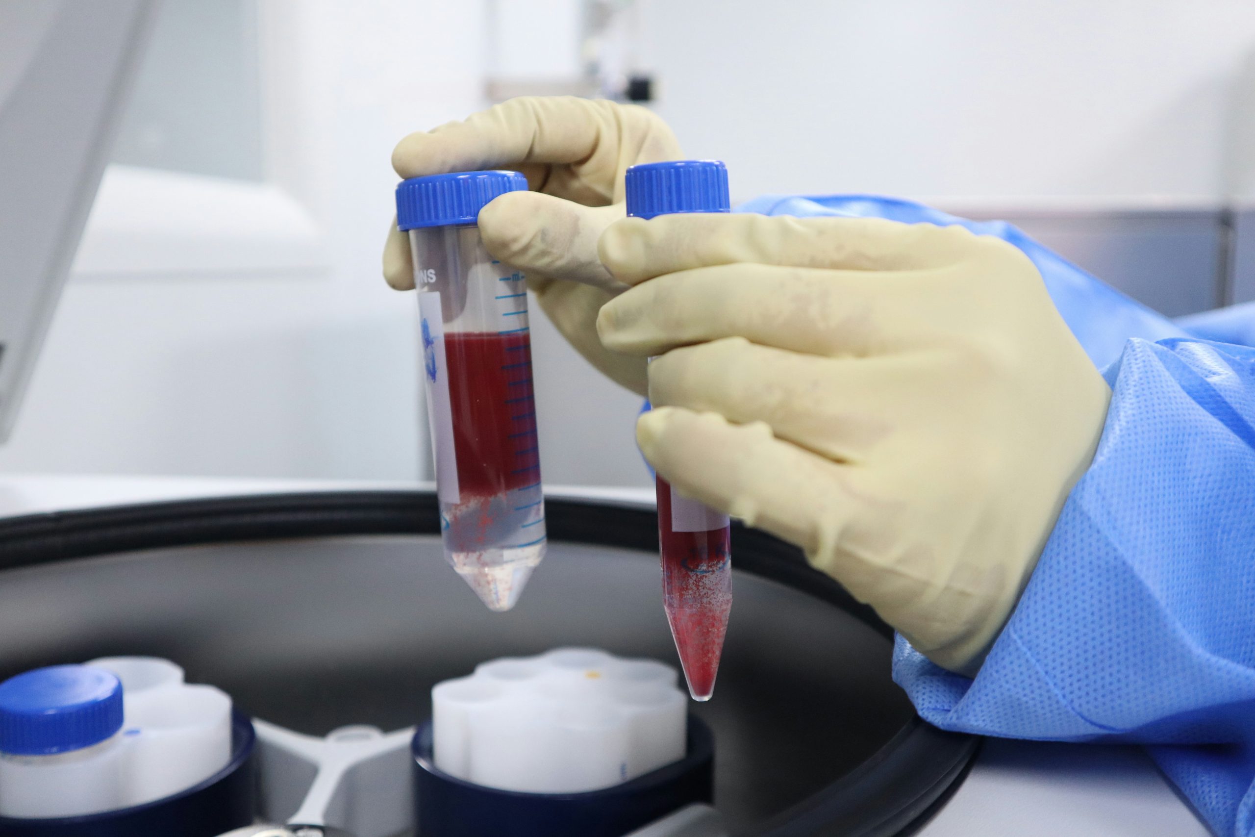 Biobanco UdeA-TdeA:  un espacio para el desarrollo en Colombia