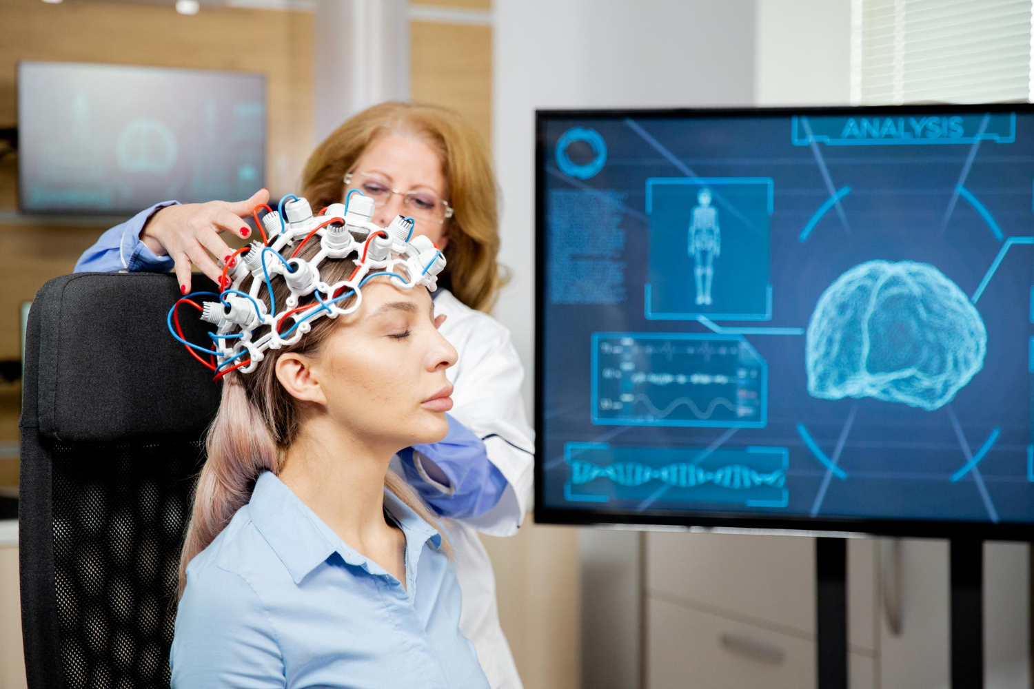 Las enfermedades cerebrovasculares también afectan a jóvenes