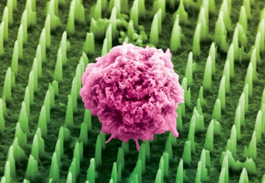 Nanoagujas como alternativa a las dolorosas biopsias de cáncer