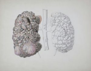 258-10-CIENCIA_Riñón cálculos_Unsplash