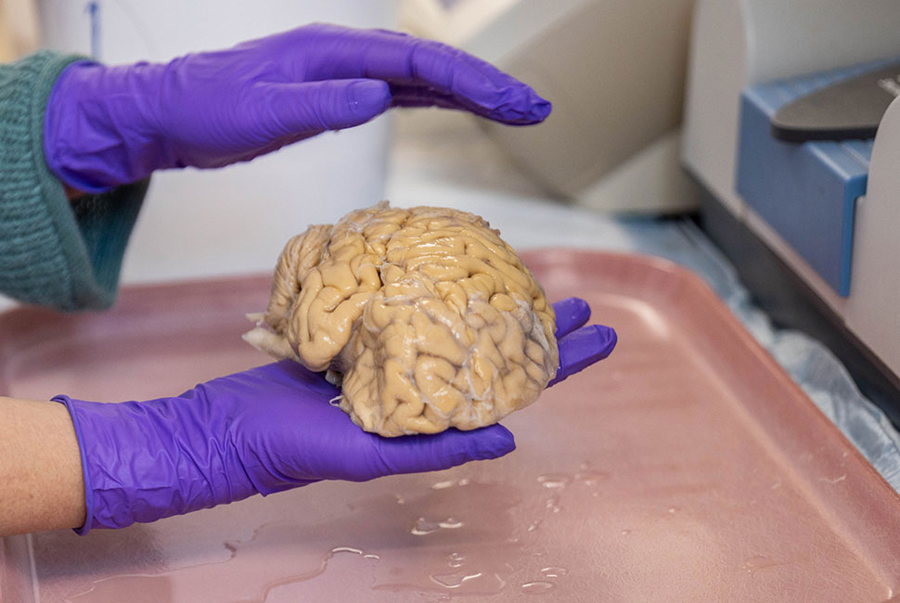 El cerebro de los ‘superancianos’ ofrece algunas claves de la eterna juventud