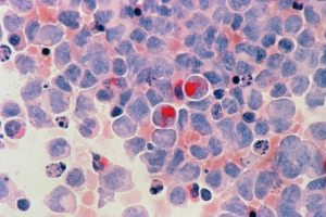 267-7-CIENCIA_Células cancerígenas_