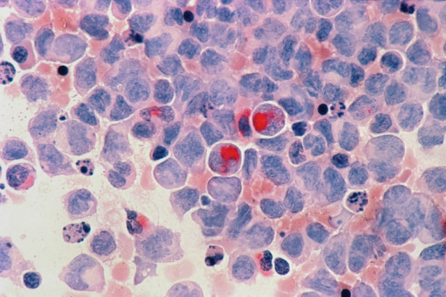 Crean compuestos que atacan células cancerígenas sin efectos secundarios