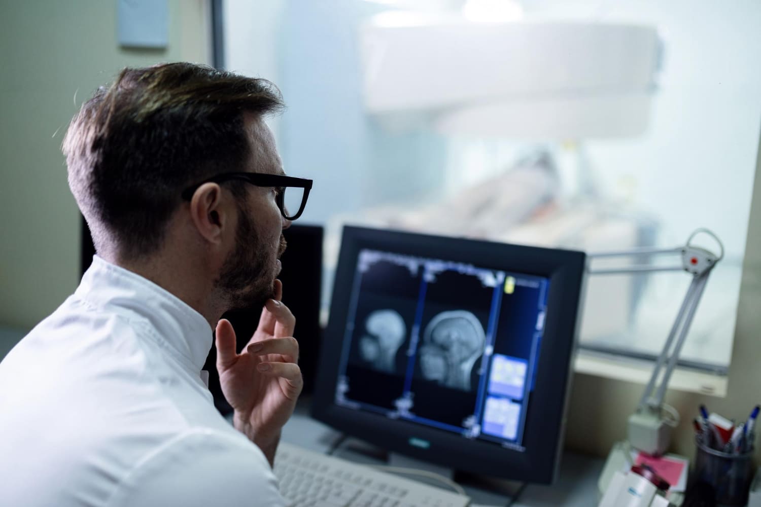 Identifican por primera vez las señales cerebrales del olvido de recuerdos desagradables