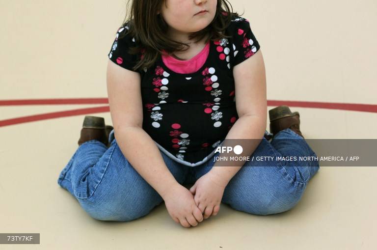 La obesidad supera por primera vez a la desnutrición entre menores de 5 a 19 años