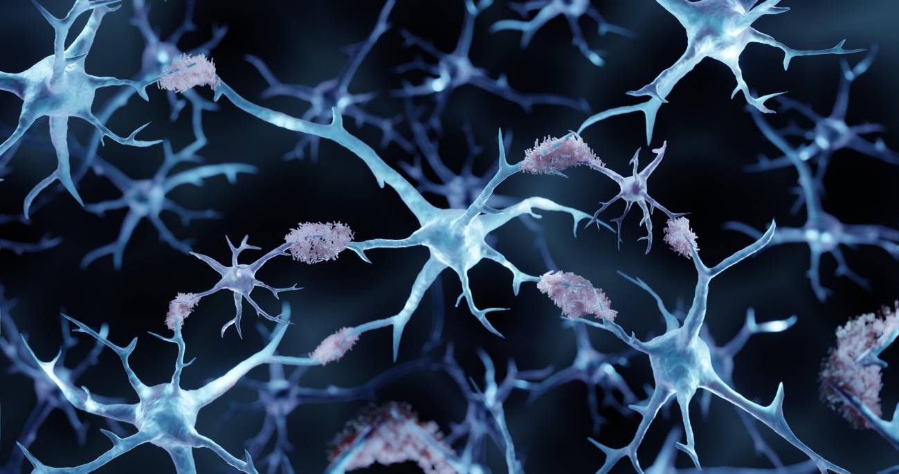 Consiguen revertir el alzhéimer en ratones con el uso de nanopartículas