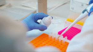 Identifican-biomarcadores-que-senalan-el-inicio-de-la-transicion-a-la-menopausia