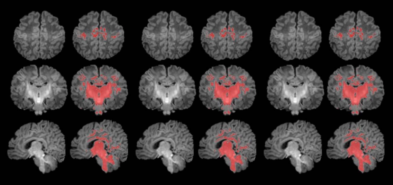 La contaminación atmosférica afecta a la maduración cerebral del bebé