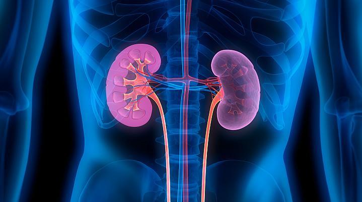 La enfermedad renal crónica es la novena causa principal de muerte en el mundo