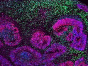 El-mayor-mapa-del-cerebro-en-desarrollo-revela-las-fases-en-las-que-se-originan-los-trastornos-neurologicos