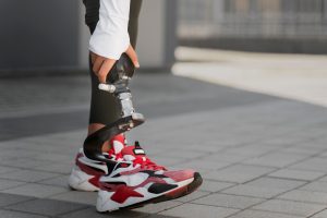 286-9-CIENCIA_Prótesis