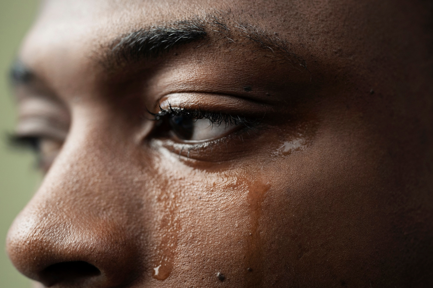 Glándulas de Meibomio, las guardianas contra el ojo seco