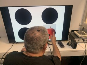 Recuperan la visión parcial en una persona ciega con microestimulación cerebral