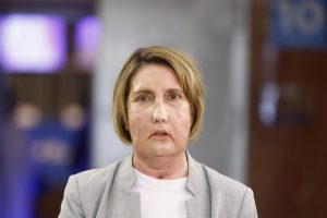 Primer trasplante de cara del mundo de una donante que recibió una eutanasia