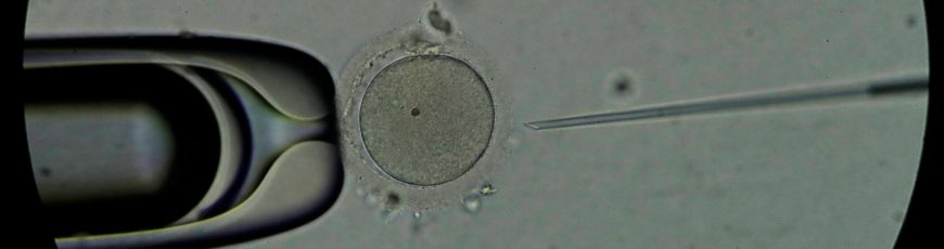 Detectan el primer caso de transmisión de una enfermedad rara mediante donante de esperma