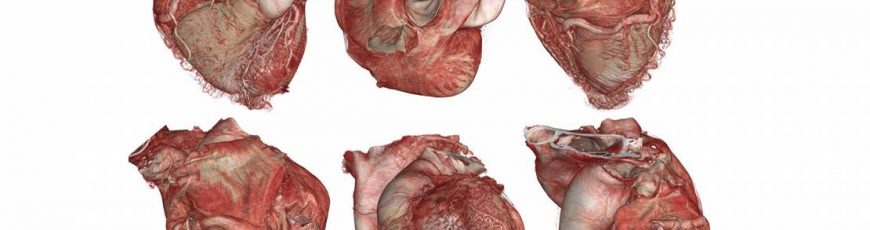 El «Google Earth» del cuerpo humano es ya una realidad