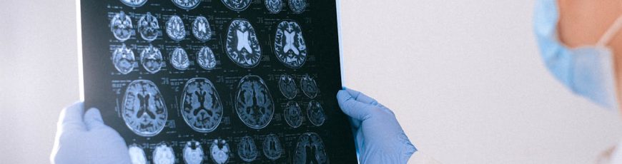 Una interfaz cerebro-computadora permite comunicarse a dos personas con parálisis