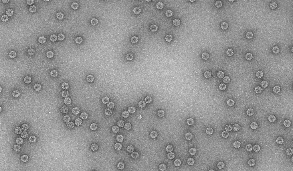 Imagen de microscopia electrónica del bacteriófago Qβ. / Mara Laguna (CNB)