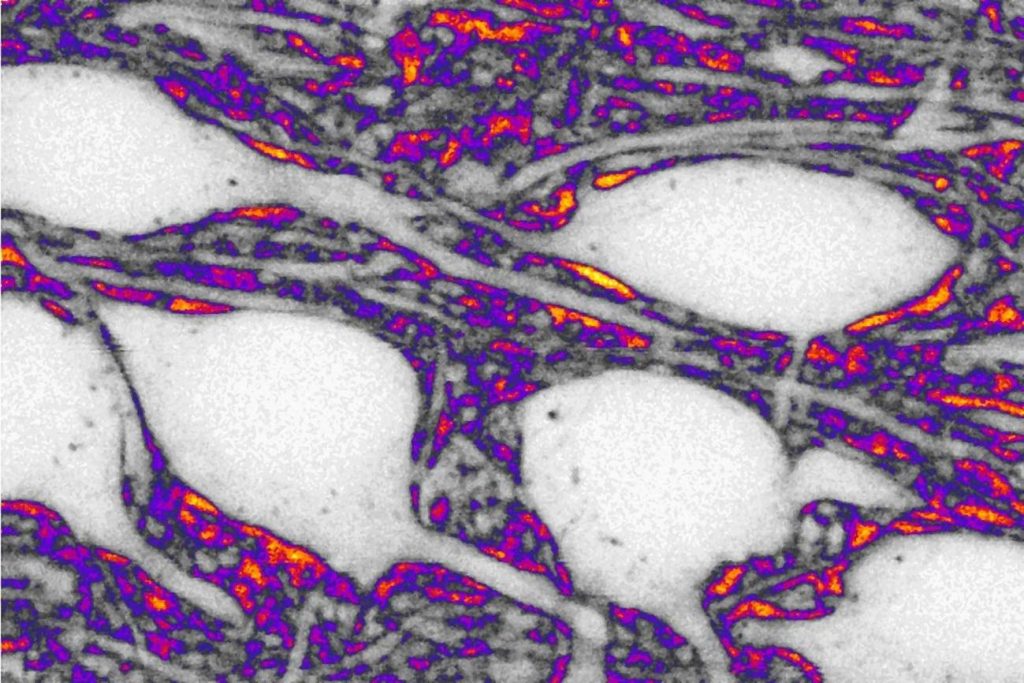 Neuronas en blanco y espacio extracelular en color. / Jan Tonnesen