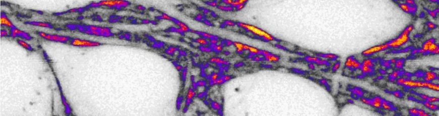 No solo importan las neuronas: el espacio entre ellas facilita la comunicación cerebral