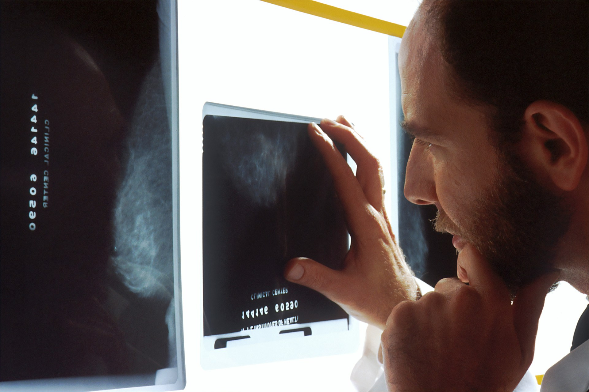 Colombia insta al diagnóstico oportuno del cáncer en adultos