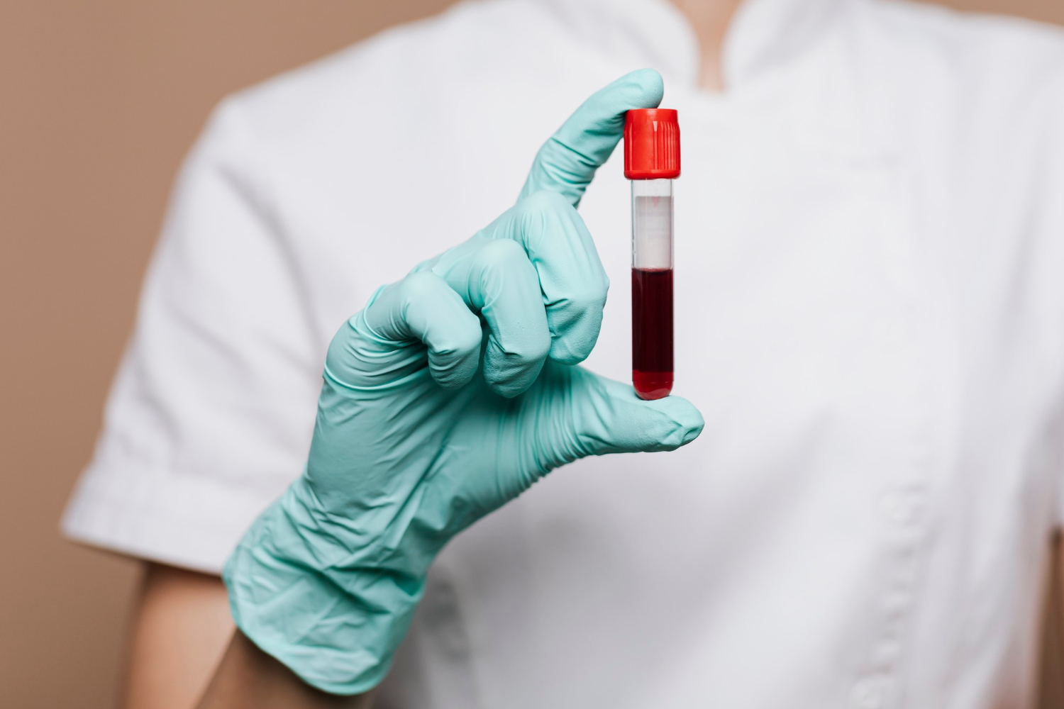 ¿Cómo funcionan los tratamientos con plasma?