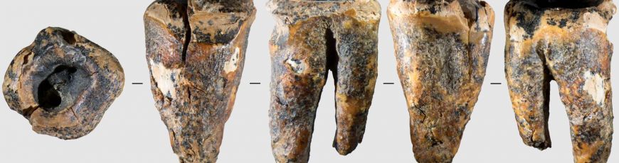 Los neandertales trataban caries usando herramientas de piedra hace 60.000 años