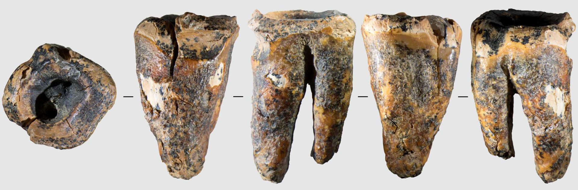 Los neandertales trataban caries usando herramientas de piedra hace 60.000 años