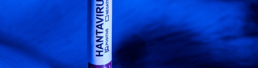 Las recomendaciones de la OMS para hacer frente al hantavirus