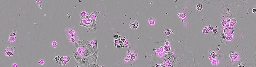 Un nuevo CRISPR actúa como ‘interruptor letal’ que destruye el ADN de células enfermas