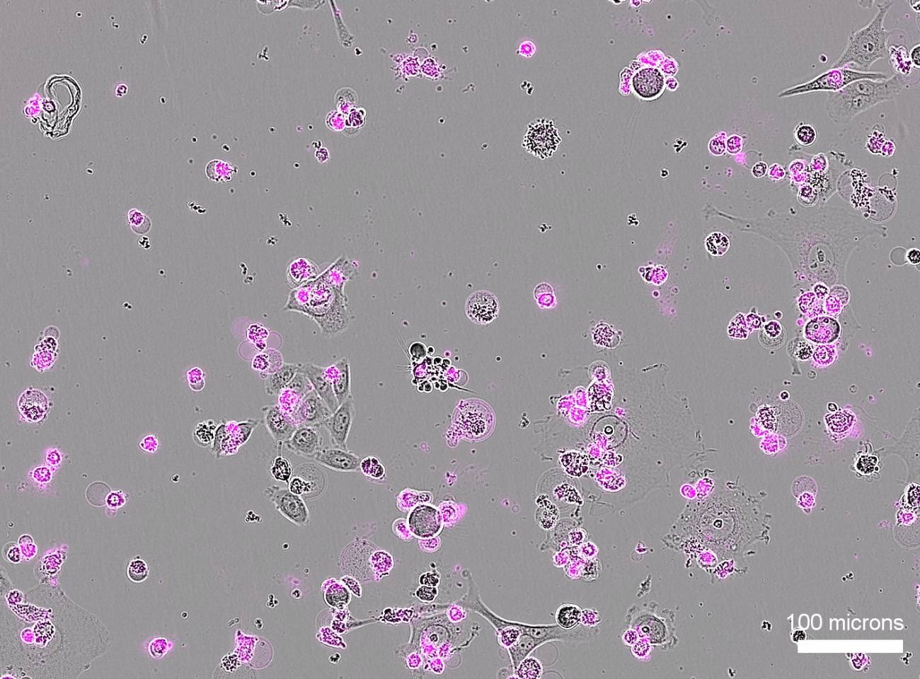Un nuevo CRISPR actúa como ‘interruptor letal’ que destruye el ADN de células enfermas