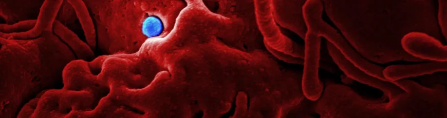 La OMS recomienda investigar anticuerpos monoclonales como tratamiento ante brote de ébola