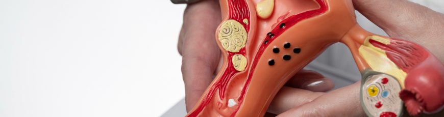 Las muertes por cáncer de cuello uterino caen a cero entre jóvenes vacunadas en Inglaterra