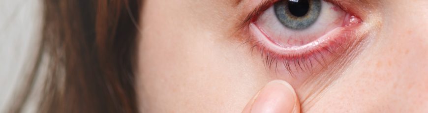 México elimina el tracoma en comunidades vulnerables de Chiapas