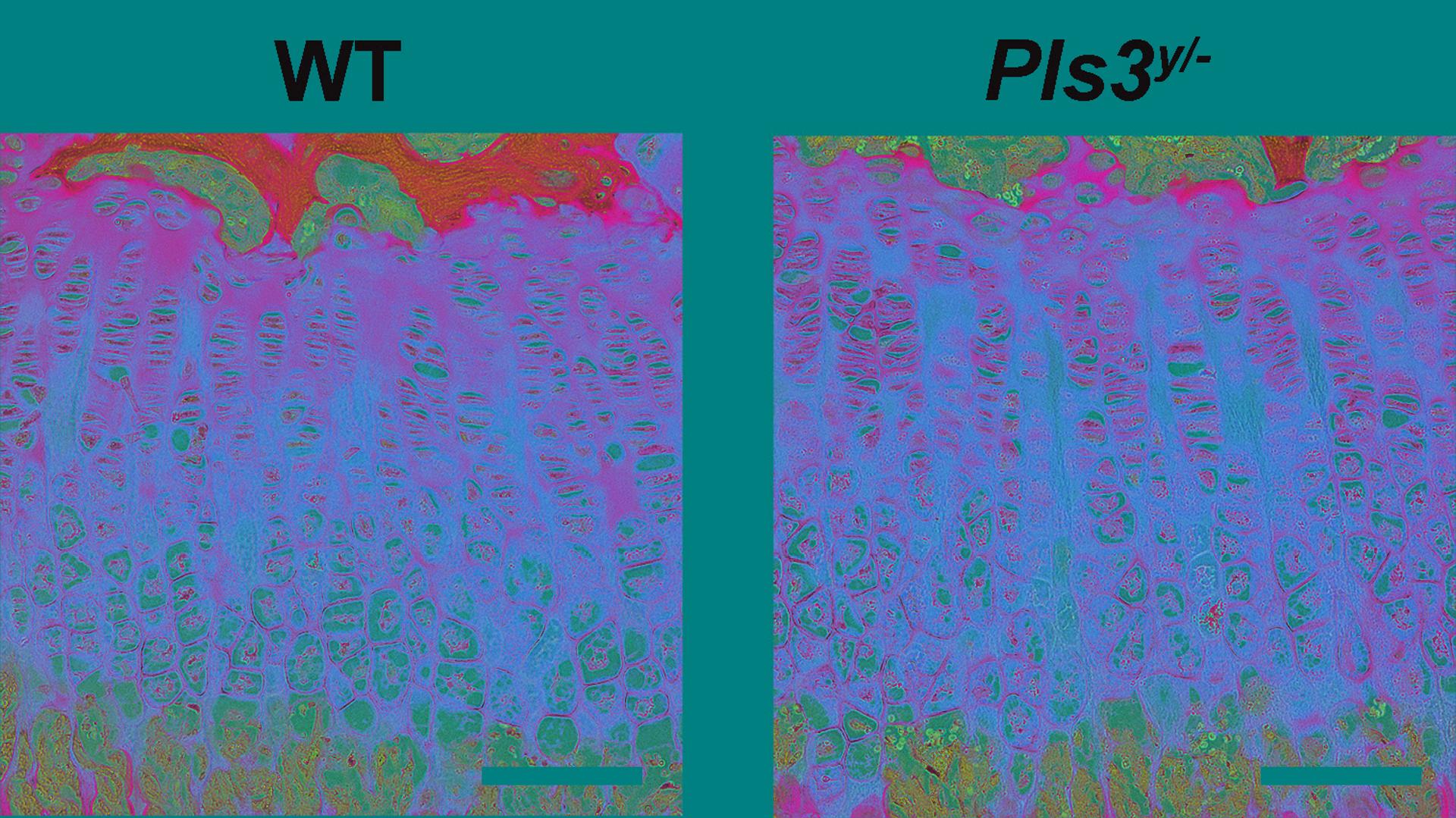 Trazan un mapa genético de las células y genes que regulan las enfermedades de los huesos